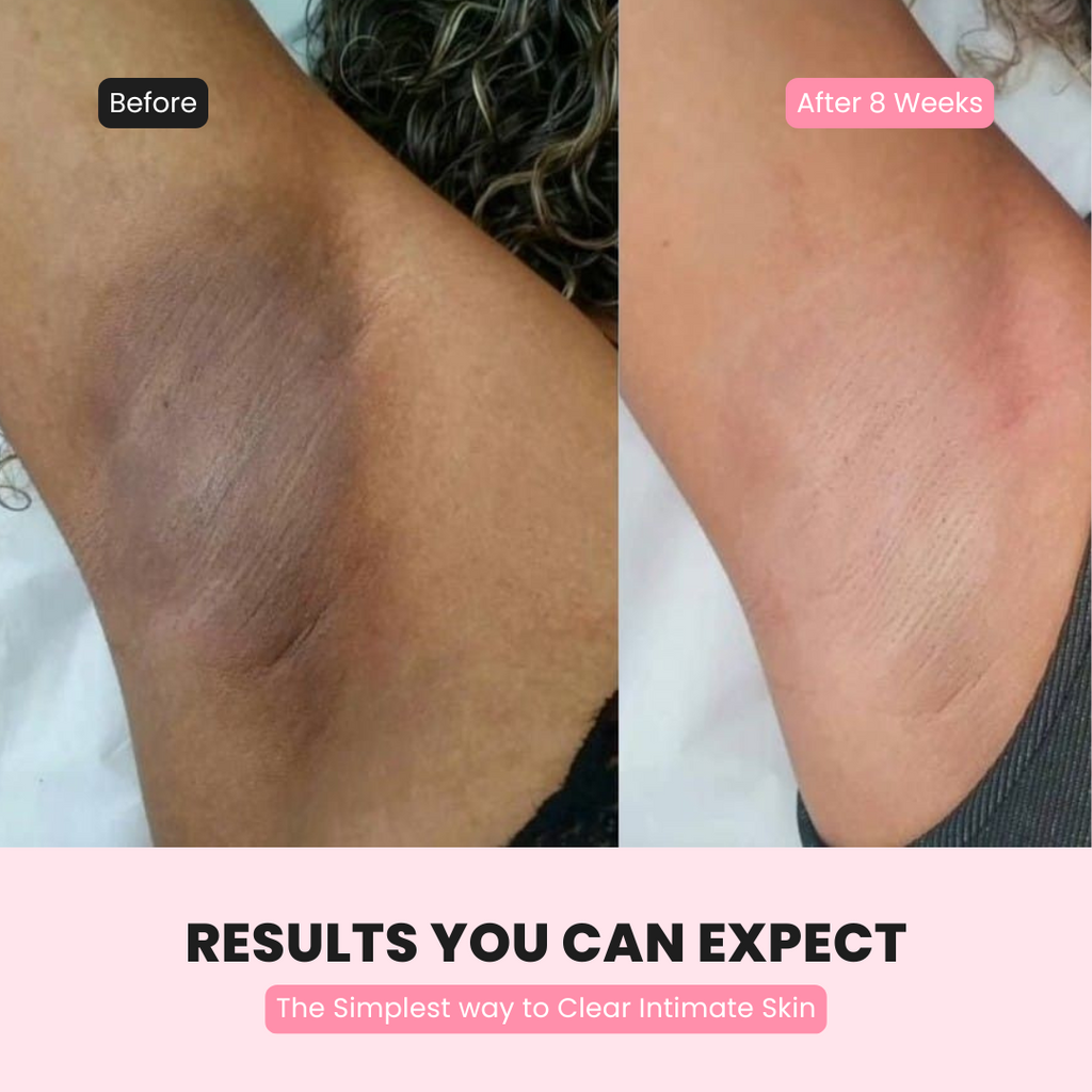Intimate Glow Serum