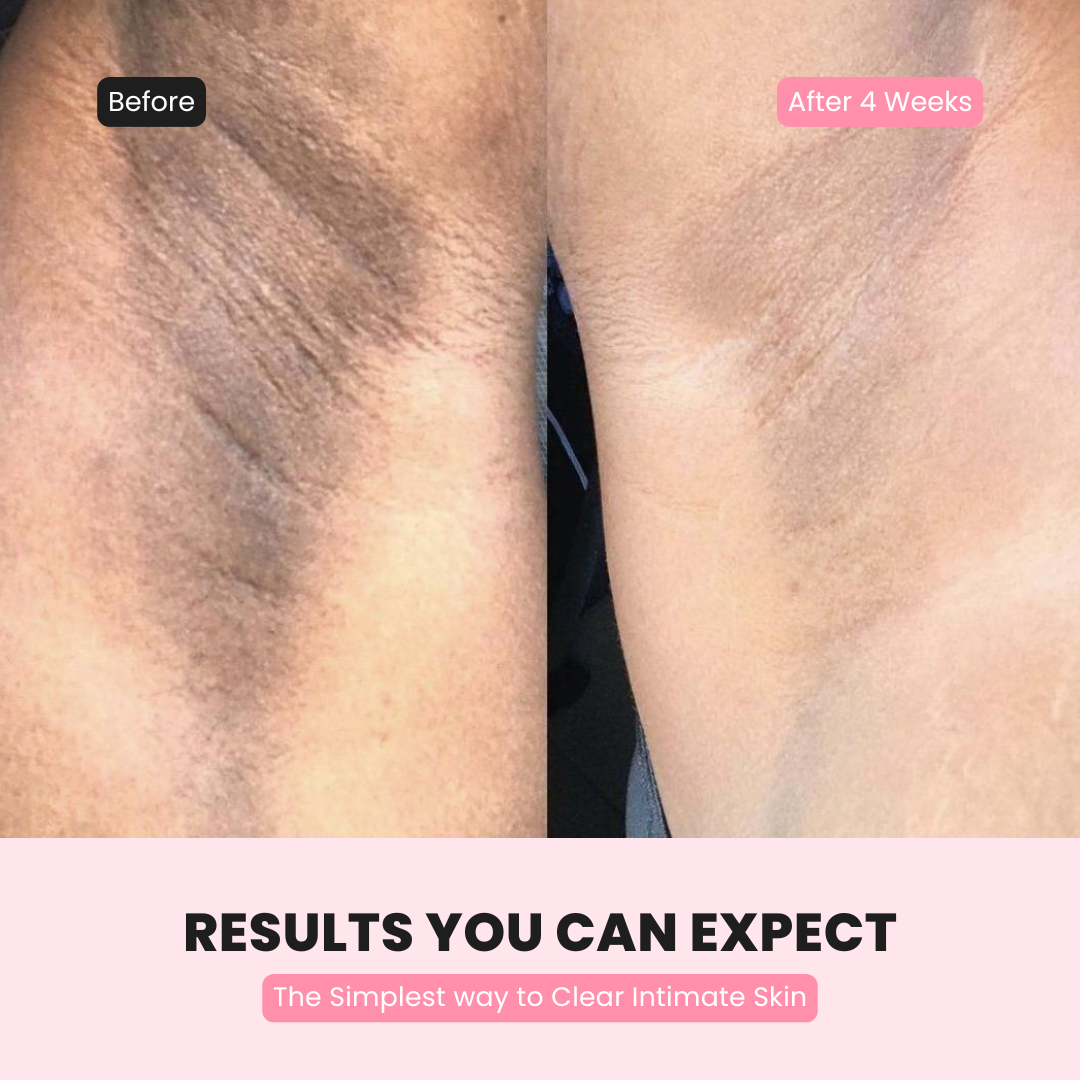 Intimate Glow Serum