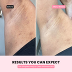 Shelay Intimate Glow Serum