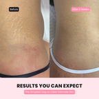 Intimate Glow Serum