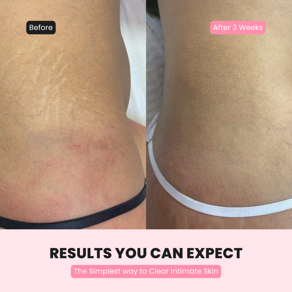 Shelay Intimate Glow Serum