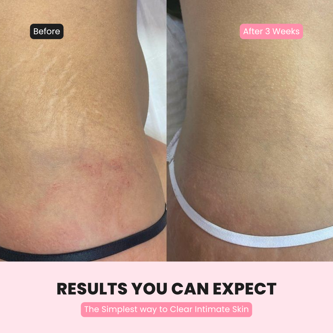 Shelay Intimate Glow Serum